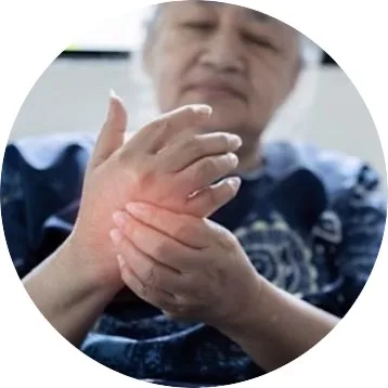膽固醇過高症狀：手腳麻痺