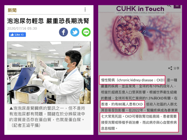 香港報道尿泡泡及腎衰竭