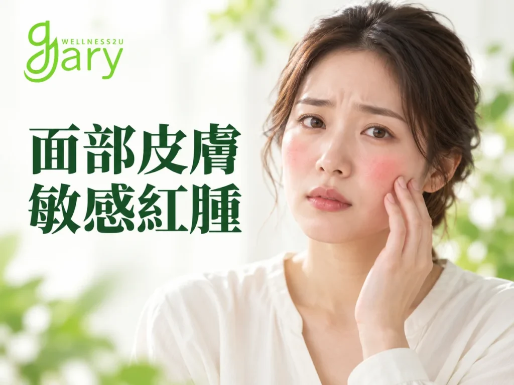 面部皮膚敏感紅腫示意圖：女性兩頰泛紅、以手觸摸臉頰皺眉，背景為綠色植物