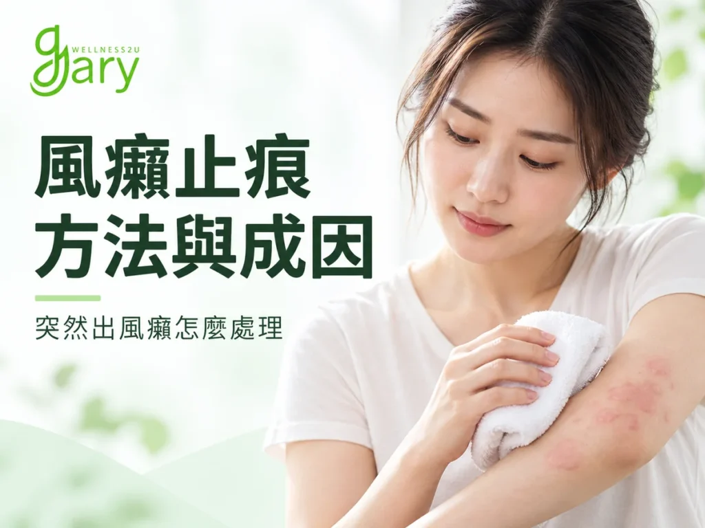 風癩止痕示意圖：女生用冷濕毛巾敷在手臂上紅腫的風癩（蕁麻疹）位置